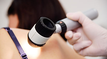 Book a skin check auckland