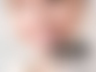 Most Popular Cosmetic Dental Services in Dubai