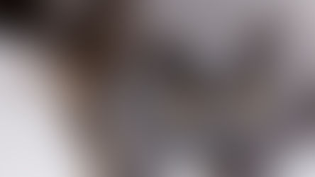 Paralysie du nerf facial