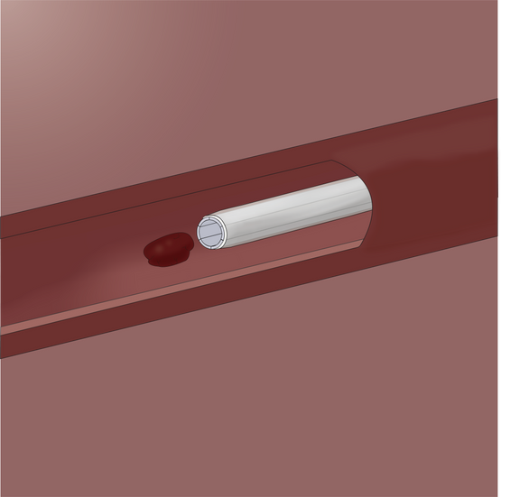 Prototype illustration & still image from animation. Wasp-inspired needle. Clot removal.