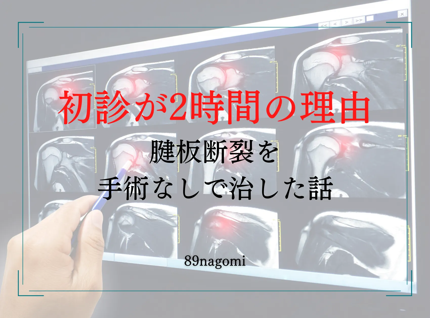初診が2時間になった理由