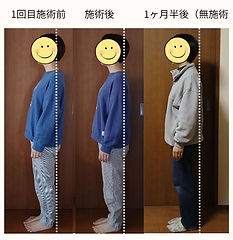 ケア前ケア後1ヶ月a.jpg