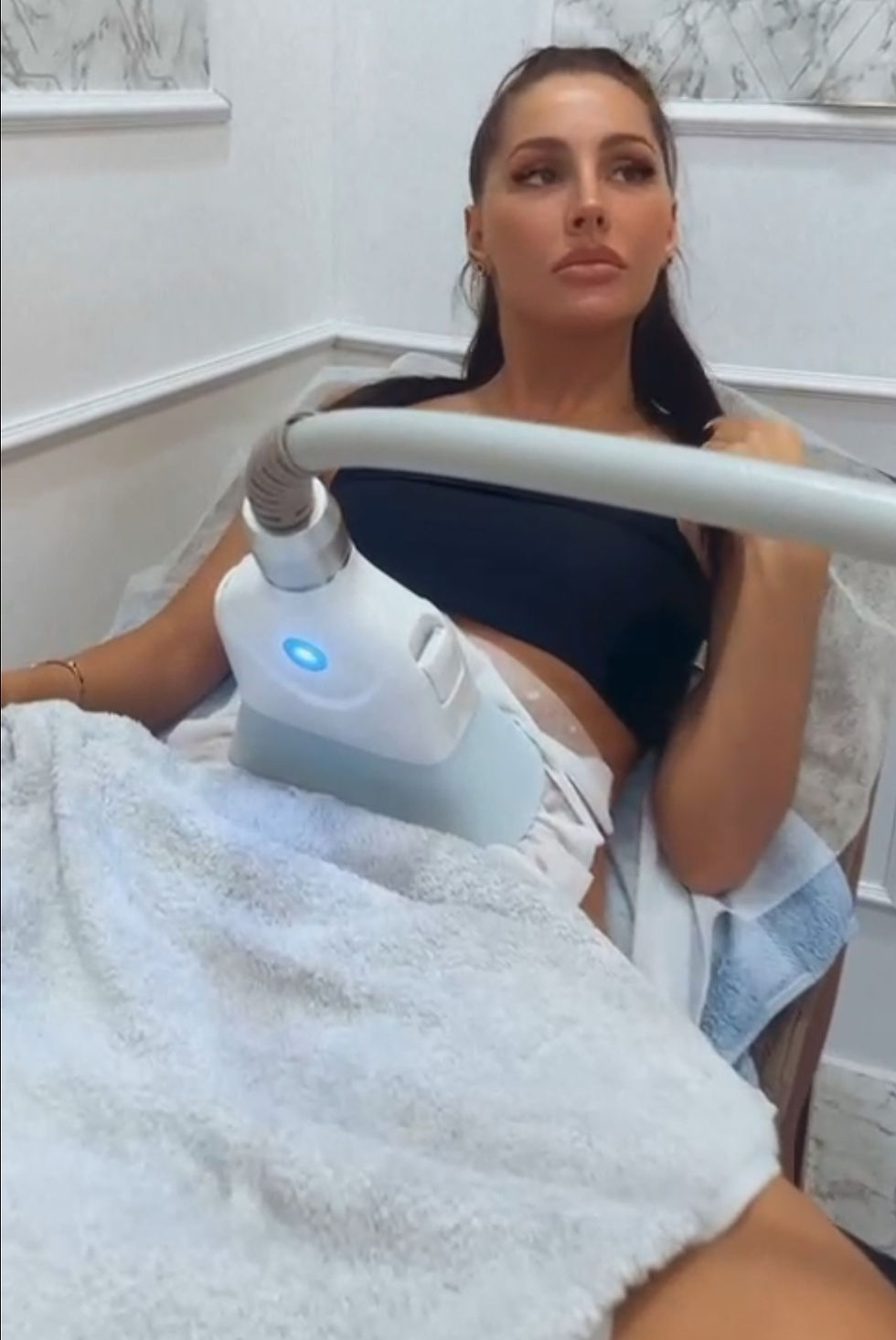Thumbnail: Stomach Area, S-Sculpt ID Pro & Super 360 Fat Freezing