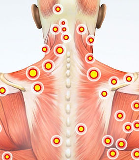dor-miofascial-gustavo-nogueira-osteopatia-fisioterapia-1024x576.jpg