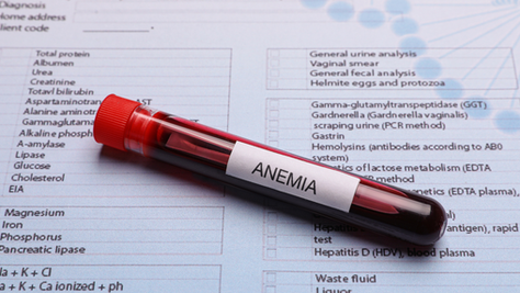 Mastering Iron-Deficiency Anaemia for the MRCP (UK) Part 1
