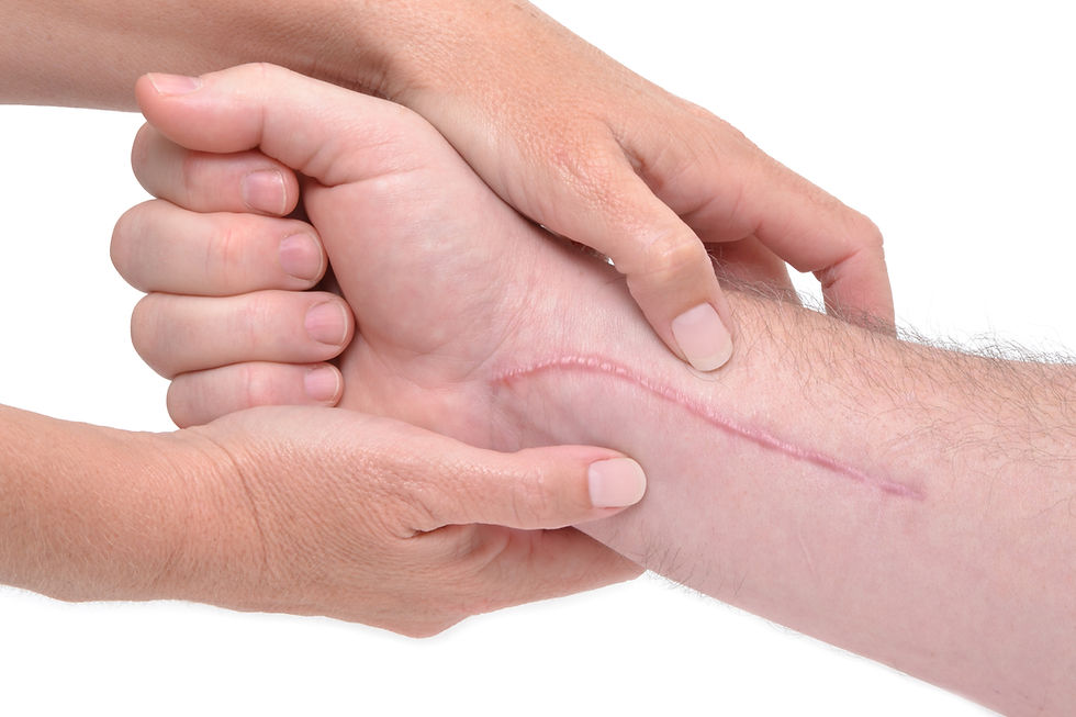 Handtherapie Beispiel