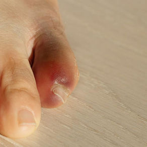 How Much Pain Is Aaron Rogers In?