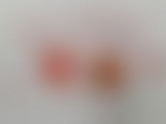 자폐증 (Autism) 아동들의 미술 심리치료