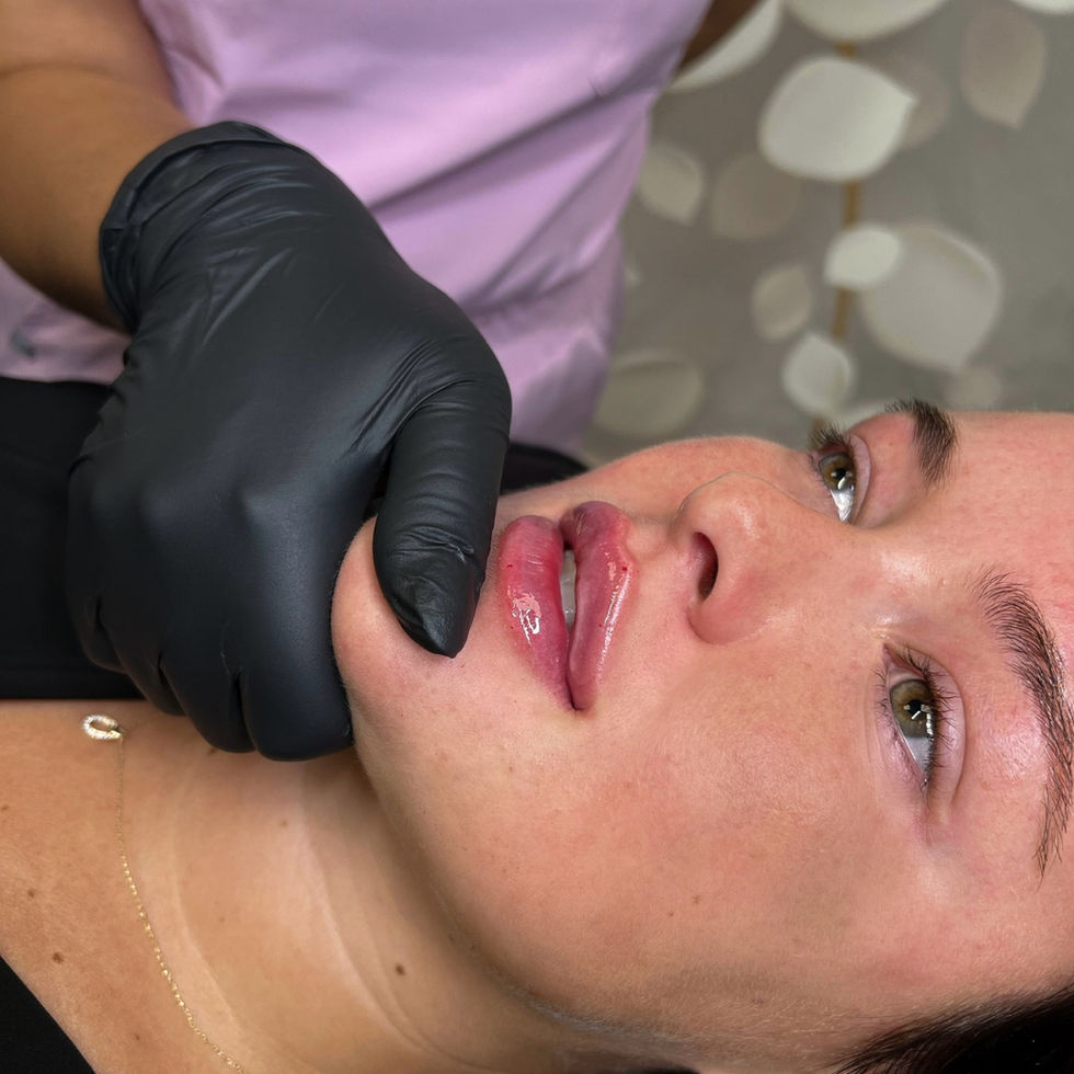 Lèvres hydratées et légèrement rehaussées après traitement à la Clinique Injection Essencia, idéales pour les clientes débutantes.