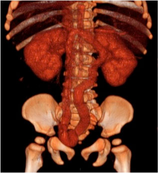 ct2.jpg
