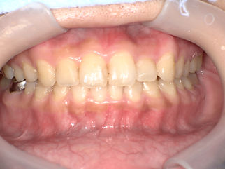 PICT0173.JPG