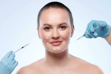 Corrective facial with fillers