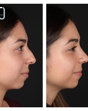 CECILIA AFONSO (4).png