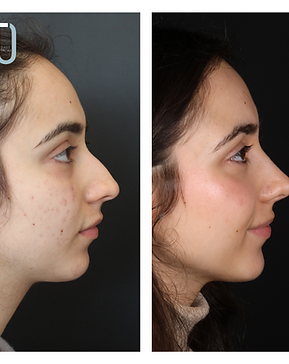 BEATRIZ BARBOSA (2).png