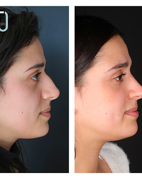 JULIANA MARTINS (2).png