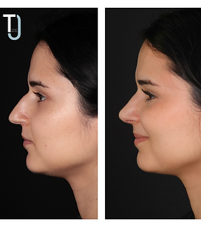 ANA ISABEL FERREIRA (4).png