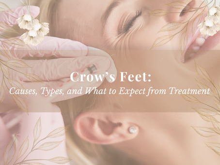 Crow’s Feet on the Sunshine Coast — Causes, Types & What to Expect | Rejuvenation by Vienna