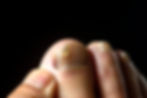 Fungal & Ingrown Nail Care.jpg