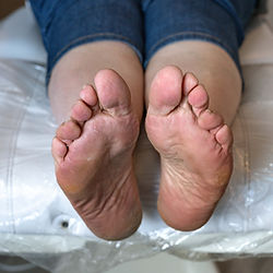 Massage treatment for foot fasciitis