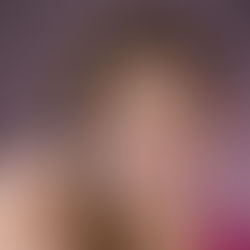 Top 5 lucruri despre aparatul dentar Invisalign