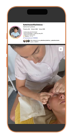 Instagramový reel, ve kterém je Kateřina Čech Lachetová v péči kosmetičky a pochvaluje si kosmetickou proceduru.