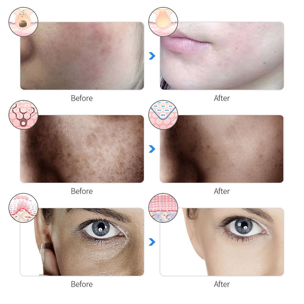 Thumbnail: Rechargeable Facial LED Mask 7 Colors LED Photon Beauty Mask Skin Rejuvenation H