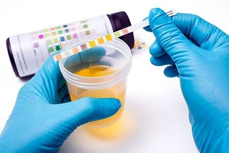  Routine Urine Examination  
