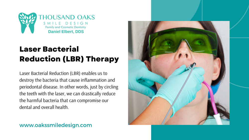 Laser Bacterial Reduction (LBR)