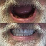 smilegallerydentures.jpeg