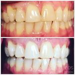 smile gallery whitening .jpeg