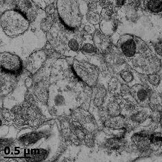 tem neuron.jpg