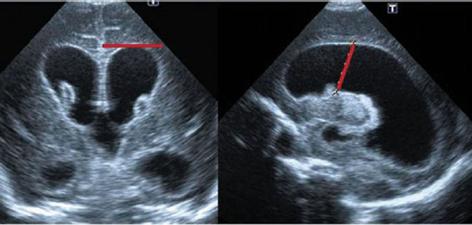 Vision de imagen de fontanela