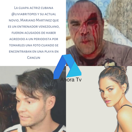
La guapa actriz cubana Livia y  su actual novio, Fueron Acusados de haber agredido a un periodista