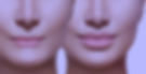 how-to-get-fuller-lips-options-1_edited.jpg