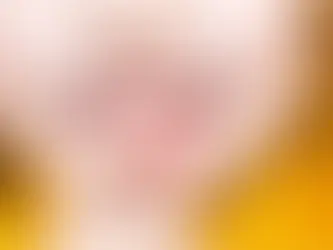 儿童矫正|很多家长都会忽略:孩子的深覆合/深覆盖,越早干预越容易改善