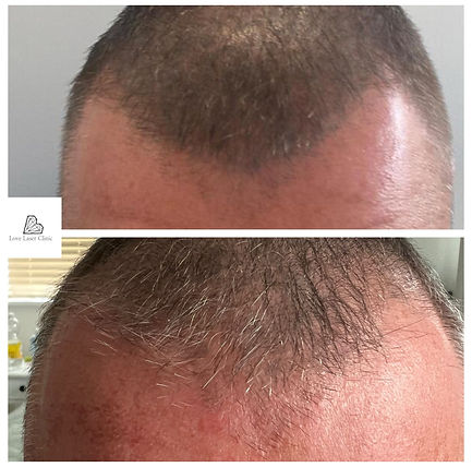 scalp1.jpeg