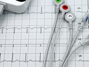 echocardiogram