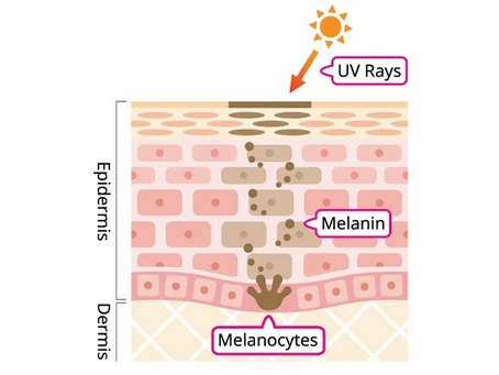 Skin Discolouration – Everything You Need to Know About this Problem