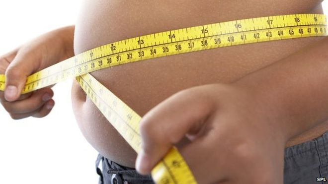 Obesidade infantil