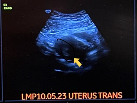 Navigating a New Normal – The First Trimester Saga