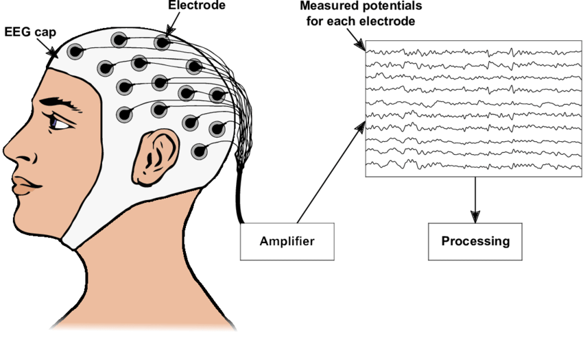 Sketch-of-how-to-record-an-Electroencephalogram-An-EEG-allows-measuring-the-electrical.png