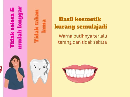 Fake Veneers
