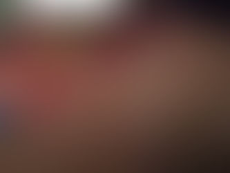 Niat nak jaga gigi tu betul.
Cara kena betul juga.
Scaling profesional lebih selamat.
Mari bersihkan gigi dengan cara selamat dan profesional bersama doktor gigi yg bertauliah di just dental clinic😉