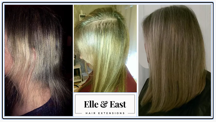 Fine Hair Fillers - Full Head Fitting - Before - During - After