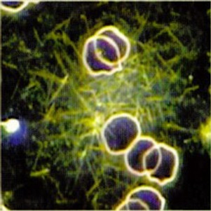 live blood example.jpg