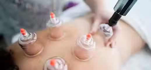 Dynamic Cupping 60min.avif