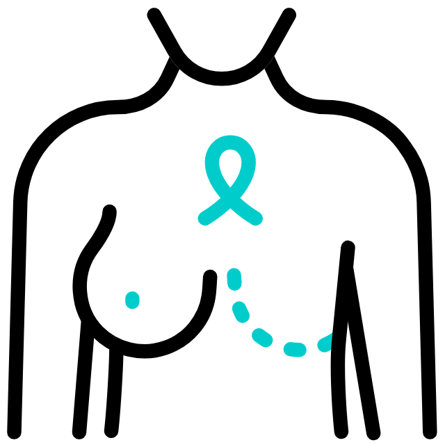breast-cancer (1).gif