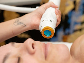 Laser for Every Skin Tone: Safe Solutions for Melanin-Rich Skin