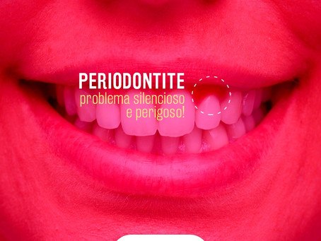 Sangramento na gengiva? Dor ao escovar? Dentes amolecem? Alguns sintomas silenciosos da Periodontite