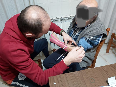 Trattamento di edemi con Taping Neuromuscolare 